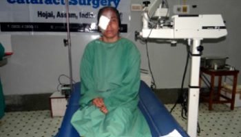 Eye Cataract_2 Eye Cataract_2